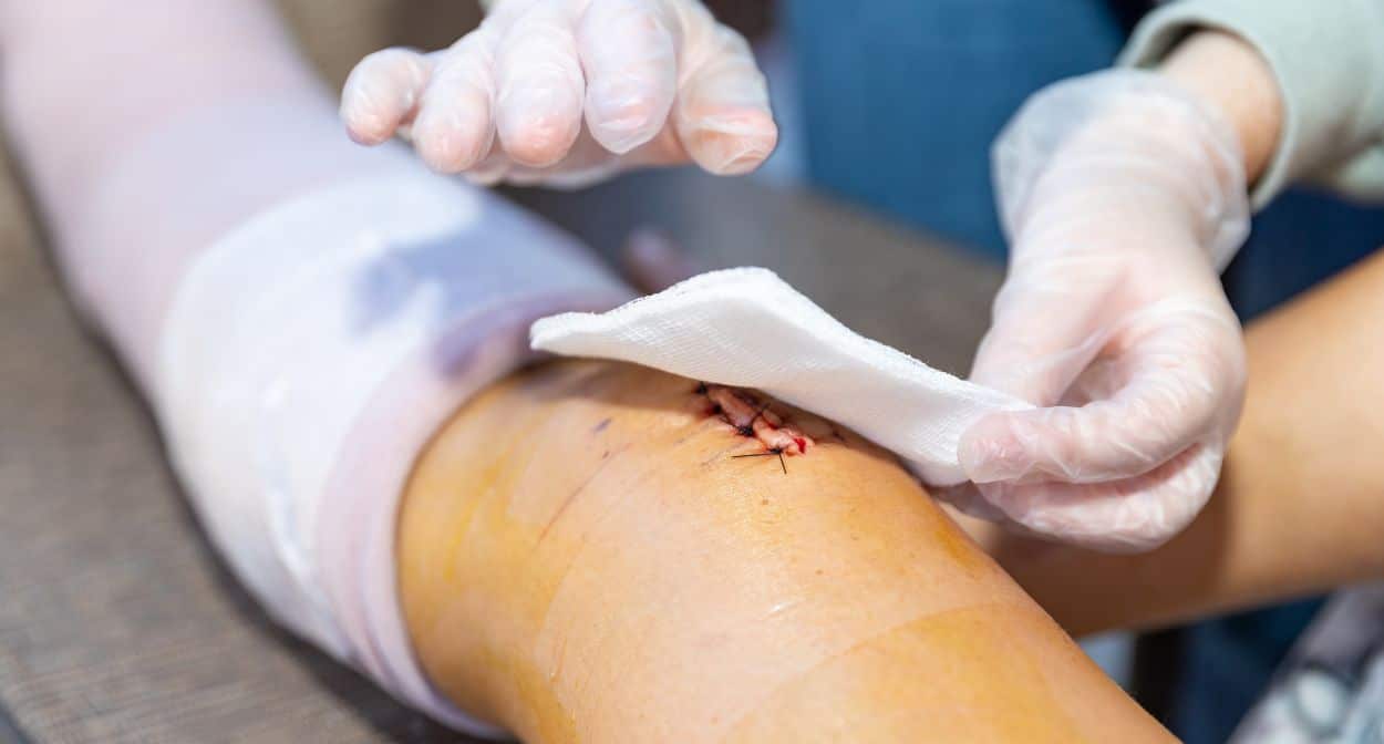 Major Wound Classifications