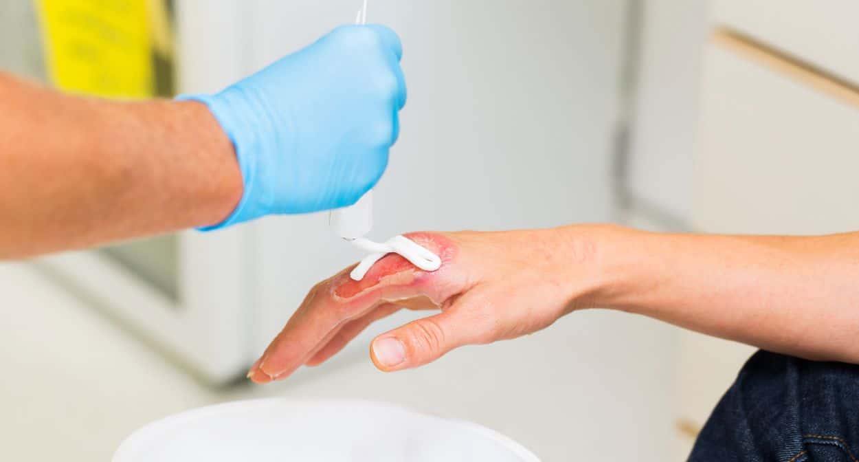 Wound Severity Surgical Wound Classifications